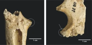 Mediolaterale Ansicht beider Ellbogengelenke
(Bild: J. Vogel, LVR-Landes Museum Bonn).